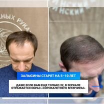 Пересадка волос с гарантией Верните густые волосы, Майкоп