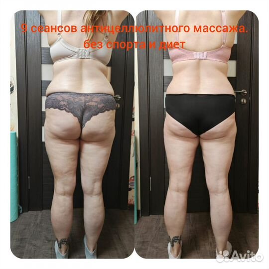 Массаж лица и тела