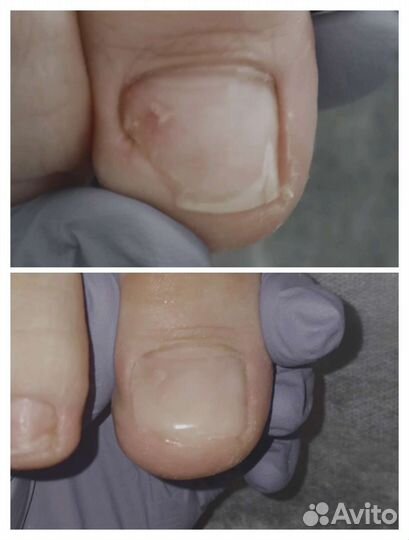 Подолог, педикюр. Выезд на дом по Приморскому р-ну