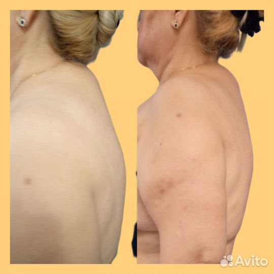 Массаж лица и тела