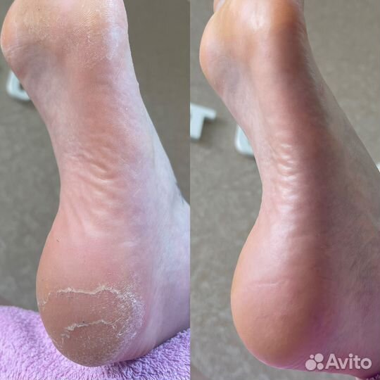 Педикюр Премиум