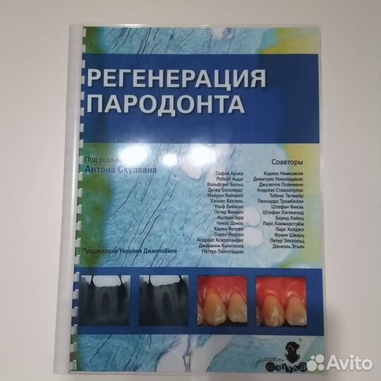 Регенерация пародонта