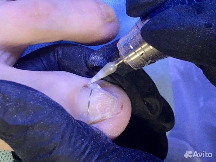 Специалист Подолог, педикюр, маникюр