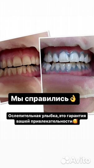 Здоровые,белоснежные зубы