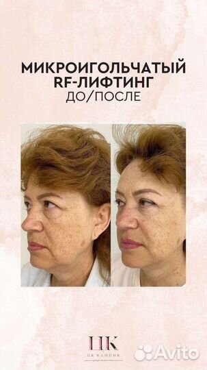 Услуги косметолога