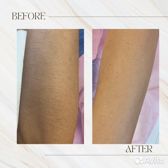 Шугаринг воск