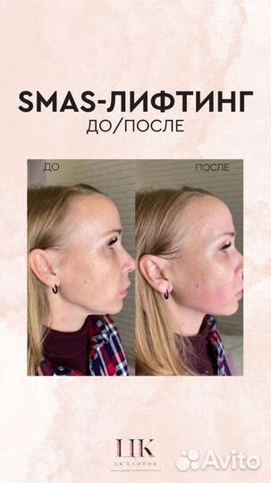 Услуги косметолога