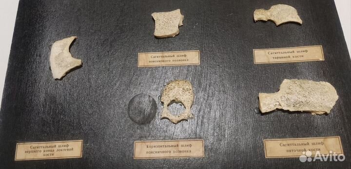 Шлифы костей (наглядное пособие)