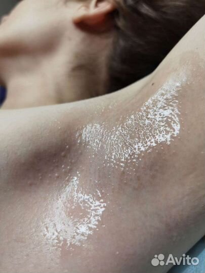 Шугаринг: подмышки