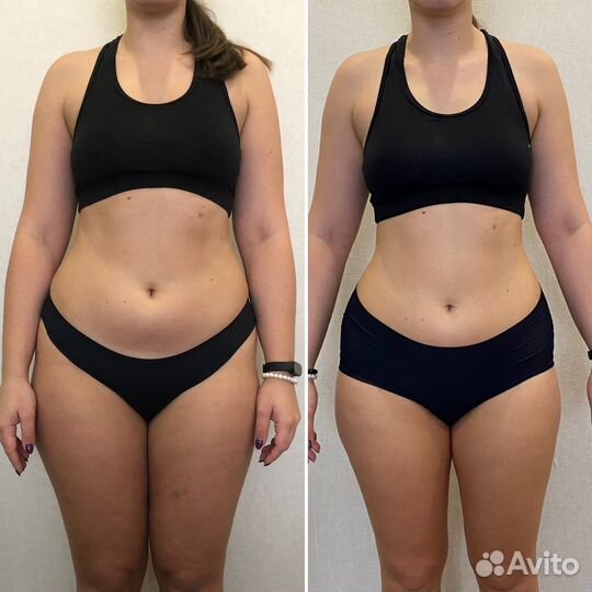 Антицеллюлитный, лимфодренажный массаж