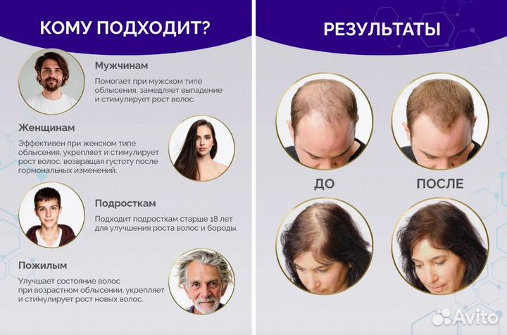 Minoxidin 5% original в наличие