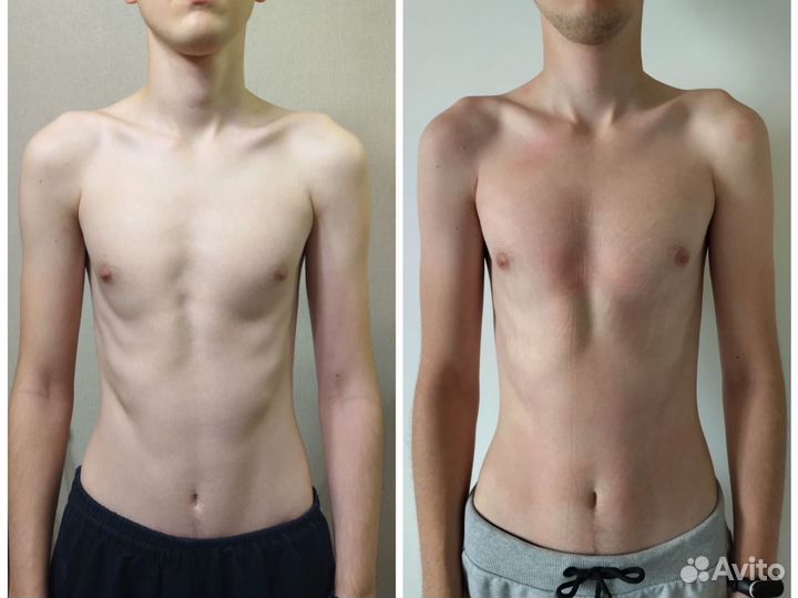 Массаж Остеопластика (остеопатический)