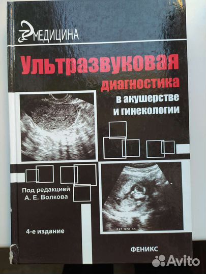 Узи в акушерстве и гинекологии