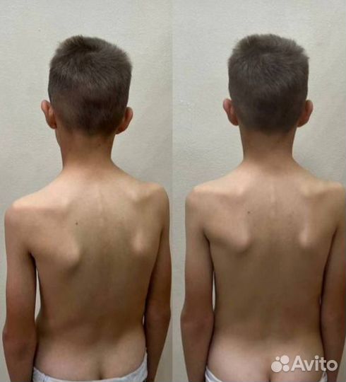 Массаж Лечебный