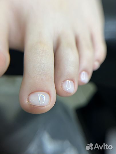 Аппаратный педикюр