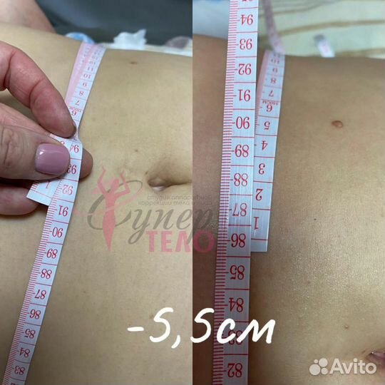 Кавитация/Вакуумный массаж/Коррекция фигуры