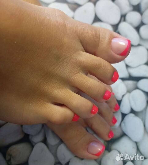 Коррекция вросшего ногтя