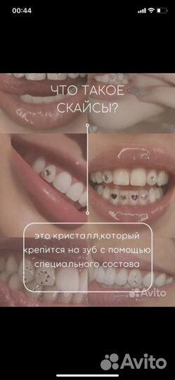 Набор для установки скайсов