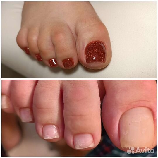 Мастер маникюра и Smart педикюра на дому