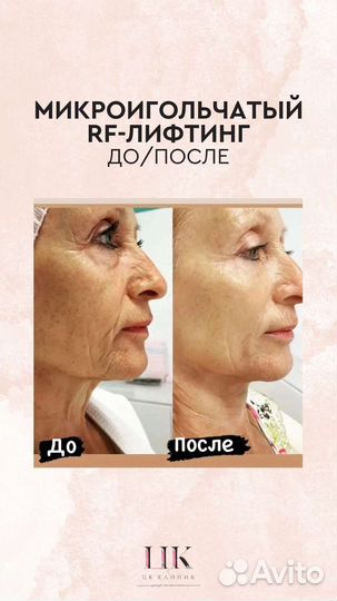 Услуги косметолога