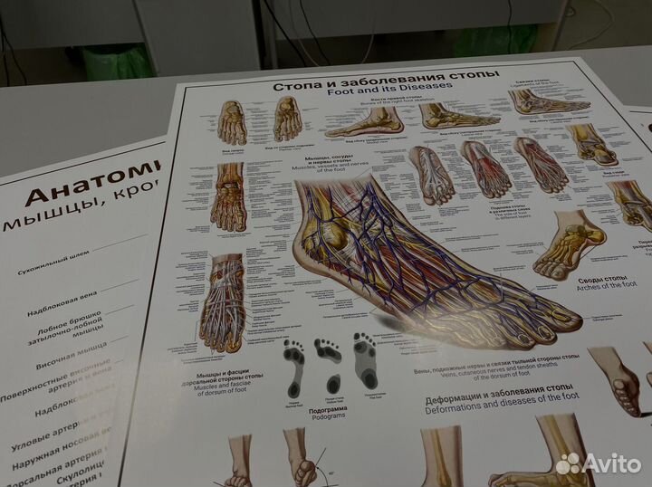 Плакат стопа и заболевания стопы