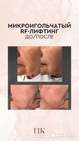 Услуги косметолога