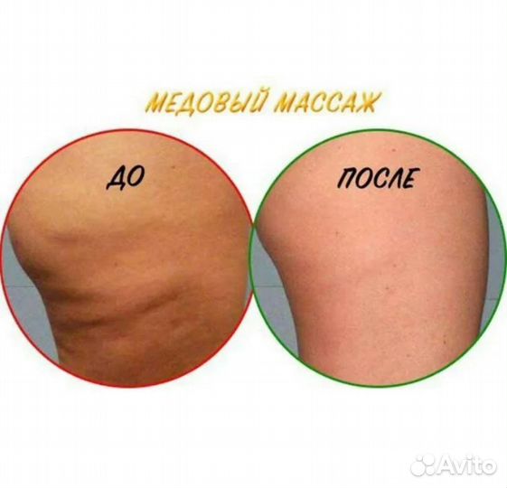 Массаж Медовый