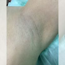 Профессиональный спа-шугаринг и восковая эпиляция, Егорьевск