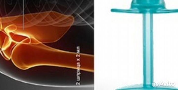 Армавиксон