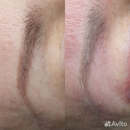 Неудачный татуаж