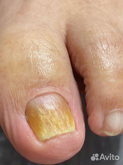 Подолог Сочи с выездом на дом