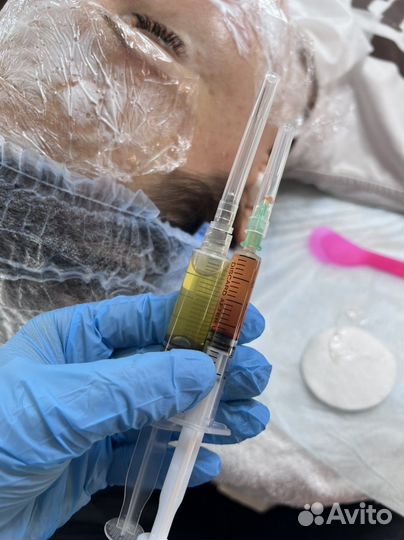 Плазматерапия