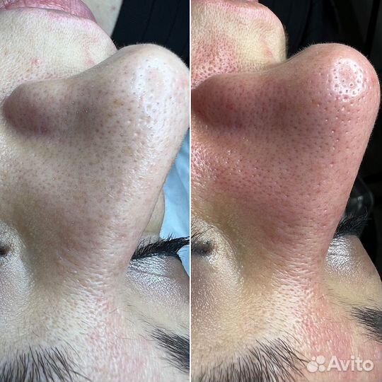 Услуги косметолога