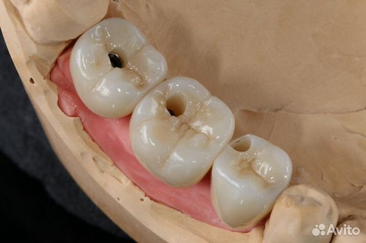 Зубной техник cad cam