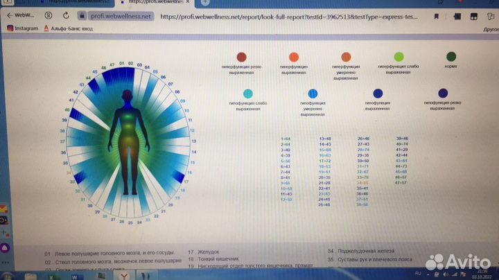 Продам (обмен) биорезонансный топ-аппарат