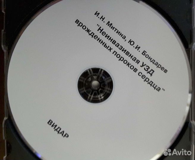 Уз-диагностика аномалий сердца плода. CD