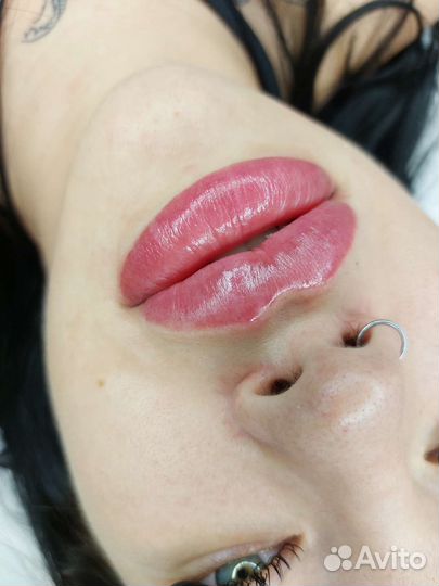 Увеличение губ косметология ботокс