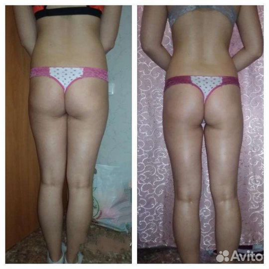 Антицеллюлитный и классический массаж