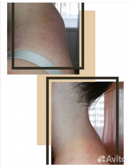 Массаж лица и тела