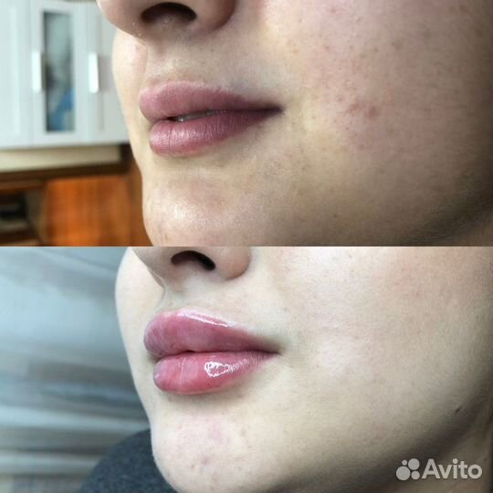 Услуги косметолога