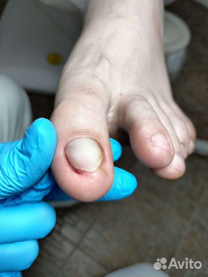 Мастер педикюра подолог