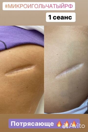 Спа-процедуры для лица