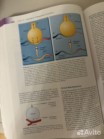 Essentials of Pathophysiology usmle Патфиз