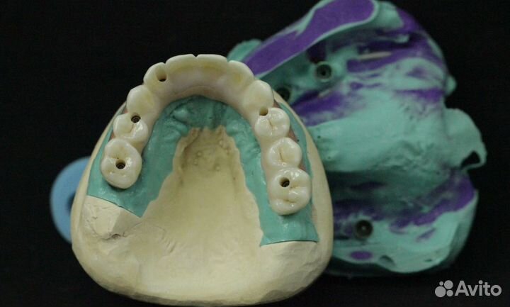 Моделирование и фрезеровка CAD/CAM ZrO2 и e.max