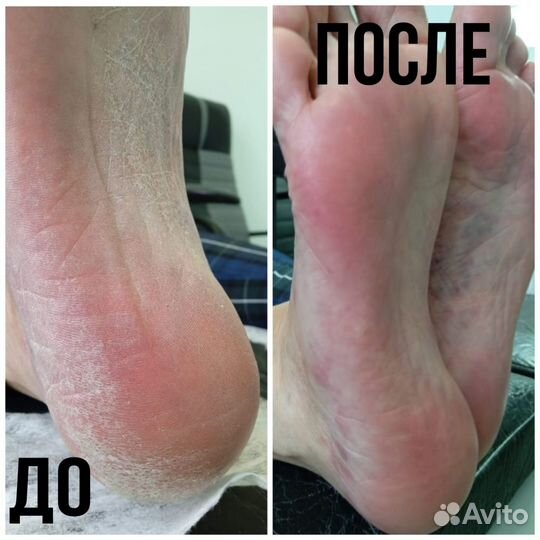 Мастер Маникюра/Педикюра