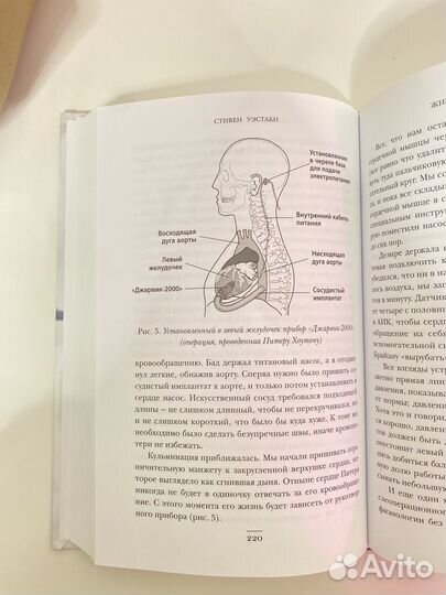 Хрупкие жизни Стивен Уэстаби