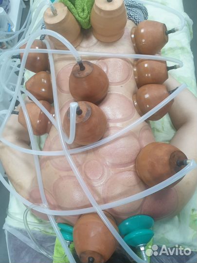 Массаж вакуумный, висцеральный, обучение хиджаме