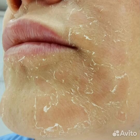 Услуги косметолога