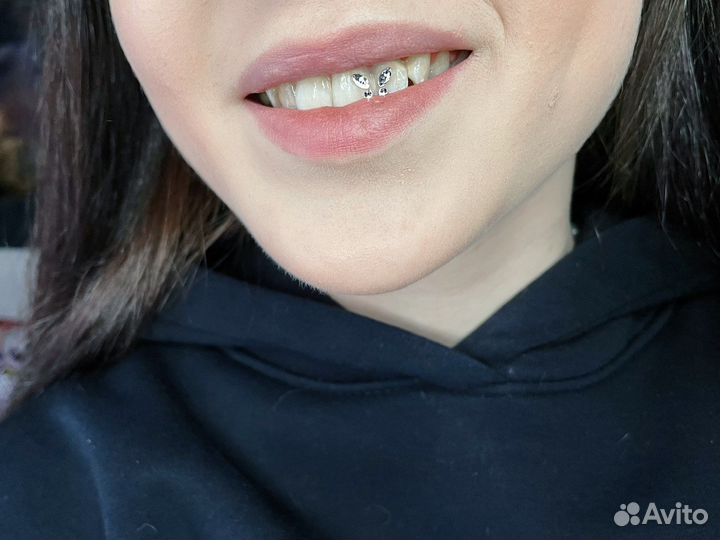 Установка скайсов (кристаллов/страз на зубы)