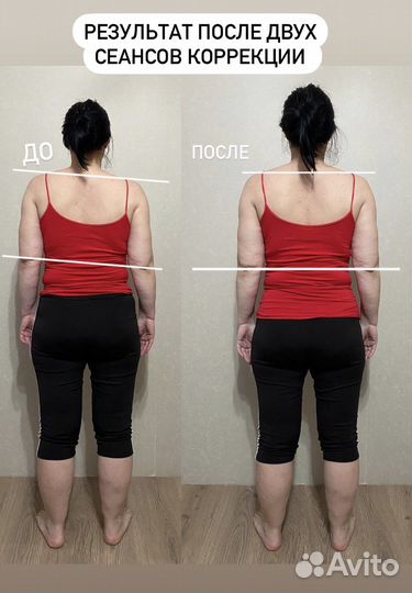 Устраняю боль, исправляю осанку